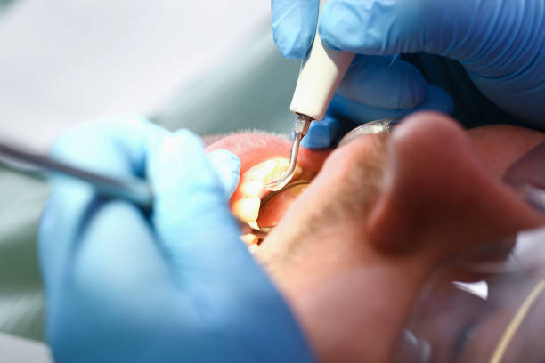 Best Emergency Treatment for Toothache in Niles, OH